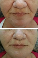 /album/fotogalerie/vyplne-jpg/