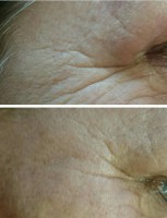 /album/fotogalerie/vyplne-jpg2-jpg/