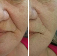 /album/fotogalerie/vyplne-jpg3-jpg/