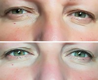 /album/fotogalerie/a38011804-10156595245700816-4897774593172832256-n-jpg/