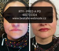 /album/fotogalerie/a101960421-645648802685455-816796487848558592-n-jpg/