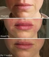 /album/fotogalerie/278925654-885414692318261-324241457326519735-n-jpg/